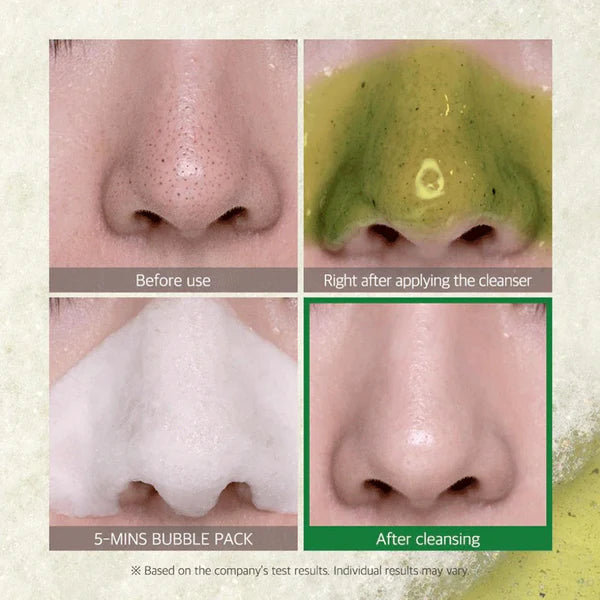 Some By Mi Bye Bye Blackhead 30 Days Miracle Green Tea Tox Bubble Cleanser 120G